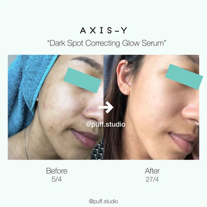 Y-axis Dark Spot Correction Serum